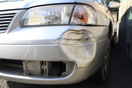 車のへこみ